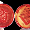 Listeria en hostelería: por qué el frío no es suficiente para evitarla - Hostelería Madrid