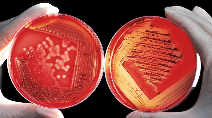 Listeria: ¿Qué es y cómo evitarla? - La Viña